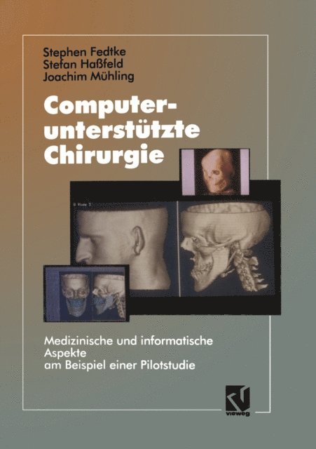 Stephen Fedtke - Computerunterstützte Chirurgie, E-bok