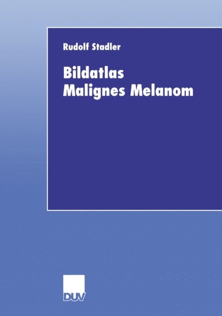 Rudolf Stadler - Bildatlas Malignes Melanom, E-bok