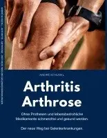André Schudel - Arthritis - Arthrose. Ohne Prothesen und lebensbedrohliche Medikamente schmerzfrei und gesund werden. Der neue Weg bei Gelenkerkrankungen, Häftad. Tillgänglighet: Lägg i varukorg