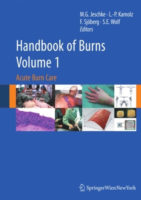 Steven E. Wolf, Folke Sjoberg, Lars-Peter Kamolz, Marc G. Jeschke - Handbook of Burns Volume 1, E-bok