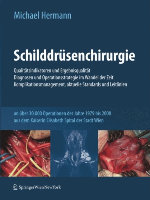 Michael Hermann - Schilddrüsenchirurgie - Qualitätsindikatoren und Ergebnisqualität, Diagnosen und Operationsstrategie im Wandel der Zeit, Komplikationsmanagement, aktuelle Standards und Leitlinien, E-bok