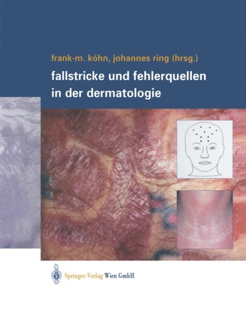 Johannes Ring, Frank-Michael Kohn - Fallstricke und Fehlerquellen in der Dermatologie, E-bok