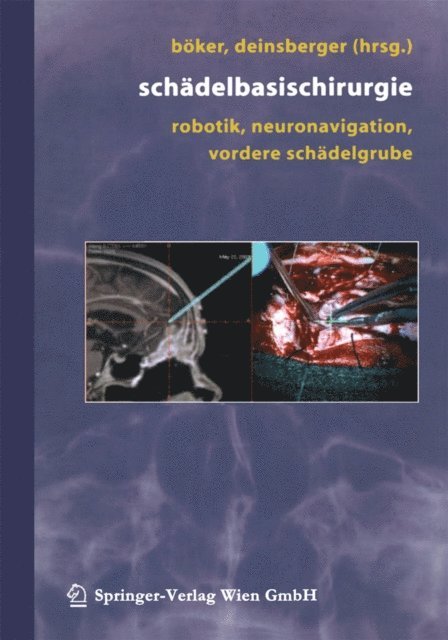 W. Deinsberger, D.-K. Boker - Schädelbasischirurgie, E-bok