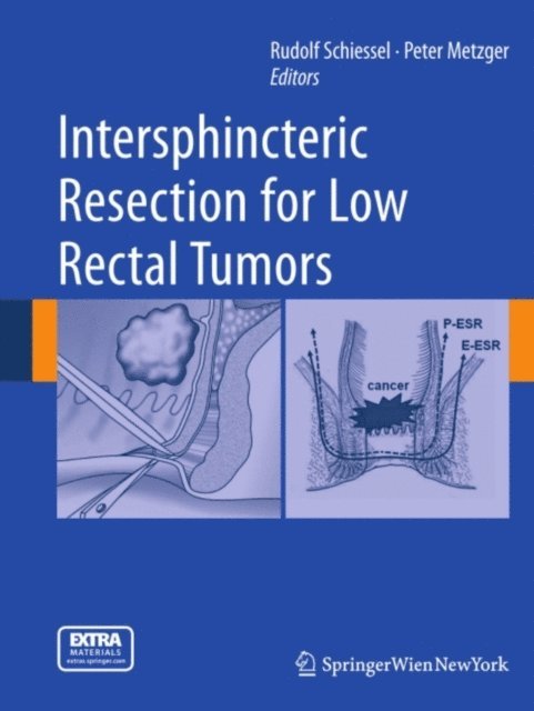 Peter Metzger, Rudolf Schiessel - Intersphincteric Resection for Low Rectal Tumors, E-bok. Tillgänglighet: Lägg i varukorg