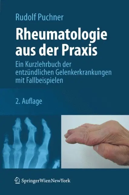 Rudolf Puchner - Rheumatologie aus der Praxis, E-bok. Tillgänglighet: Lägg i varukorg