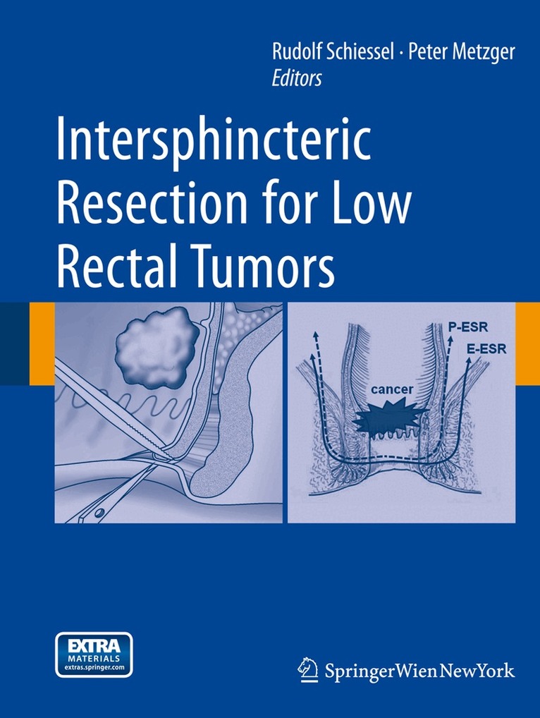 Rudolf Schiessel, Peter Metzger - Intersphincteric Resection for Low Rectal Tumors, Häftad. Tillgänglighet: Lägg i varukorg