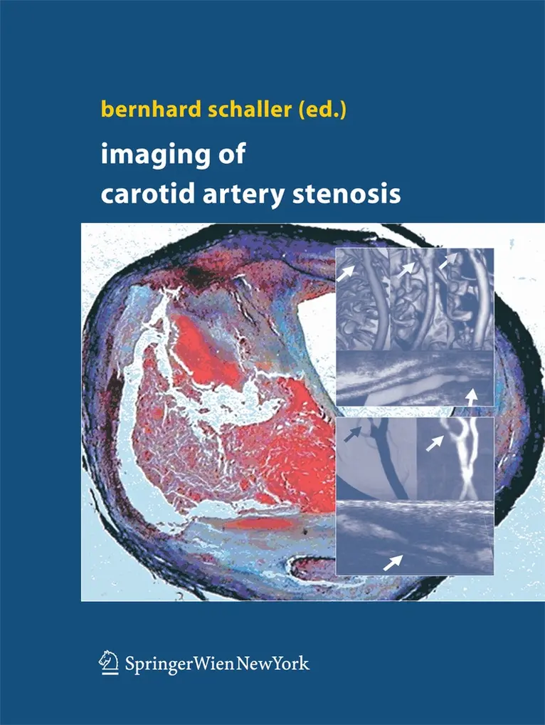 Bernhard Schaller - Imaging of Carotid Artery Stenosis, Häftad. Tillgänglighet: Lägg i varukorg