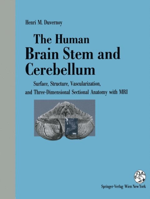Henri M. Duvernoy - Human Brain Stem and Cerebellum, E-bok
