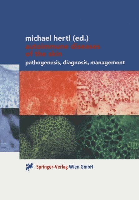 Michael Hertl - Autoimmune Diseases of the Skin, E-bok