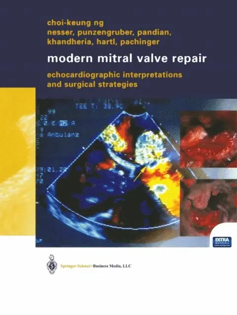 Choi-Keung Ng - Modern Mitral Valve Repair, E-bok. Tillgänglighet: Lägg i varukorg