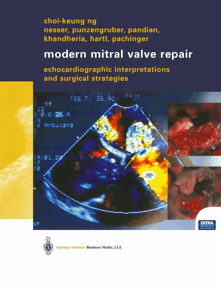 Choi-Keung Ng - Modern Mitral Valve Repair, Häftad. Tillgänglighet: Lägg i varukorg