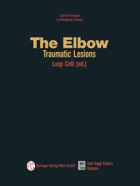 Luigi Celli - Elbow, E-bok