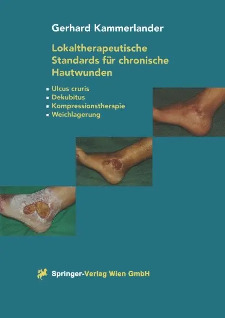 Gerhard Kammerlander - Lokaltherapeutische Standards für chronische Hautwunden, E-bok. Tillgänglighet: Lägg i varukorg