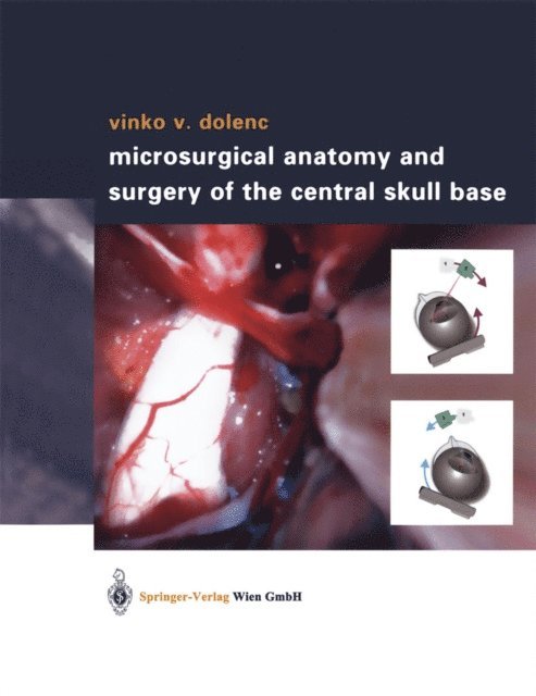 Vinko V. Dolenc - Microsurgical Anatomy and Surgery of the Central Skull Base, E-bok. Tillgänglighet: Lägg i varukorg