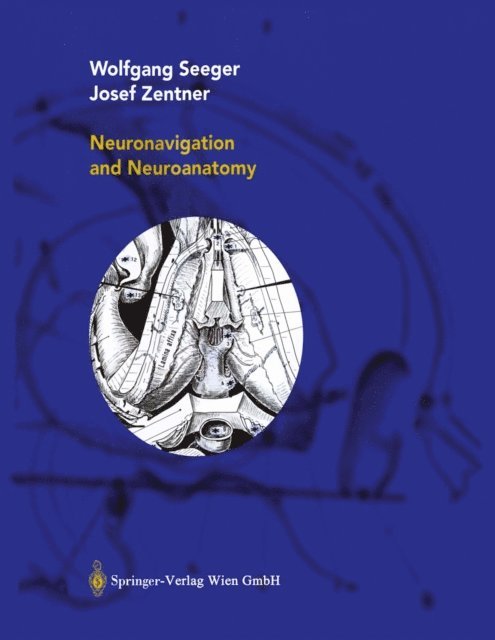 Josef Zentner, Wolfgang Seeger - Neuronavigation and Neuroanatomy, E-bok