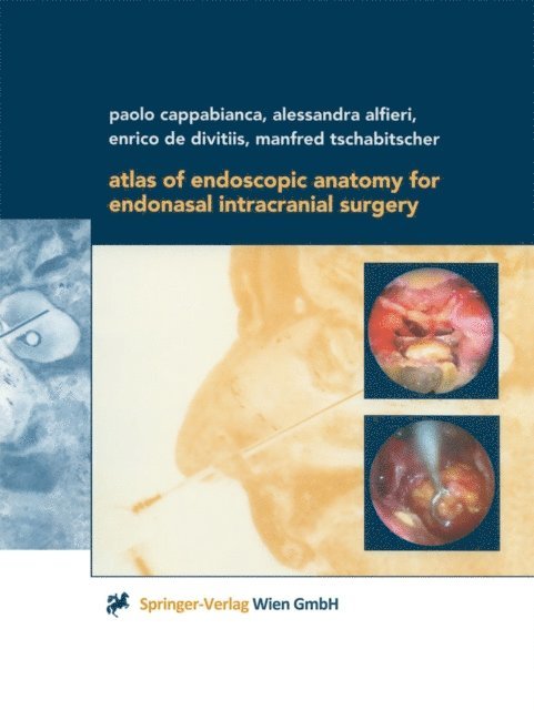 Manfred Tschabitscher, Enrico de Divitiis, Alessandra Alfieri, Paolo Cappabianca - Atlas of Endoscopic Anatomy for Endonasal Intracranial Surgery, E-bok
