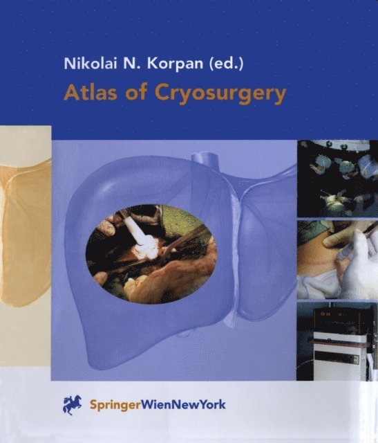 Nikolai N. Korpan - Atlas of Cryosurgery, E-bok