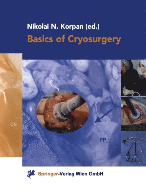 Nikolai N. Korpan - Basics of Cryosurgery, E-bok