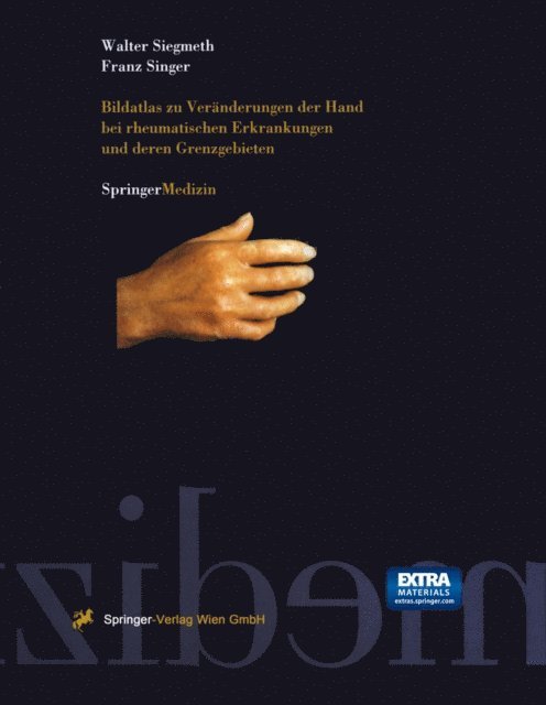 Franz Singer, Walter Siegmeth - Bildatlas zu Veränderungen der Hand bei rheumatischen Erkrankungen und deren Grenzgebieten, E-bok