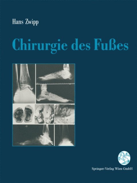 Hans Zwipp - Chirurgie des Fußes, E-bok