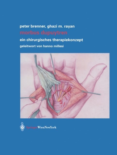 Ghazi M. Rayan, Peter Brenner - Morbus Dupuytren, E-bok