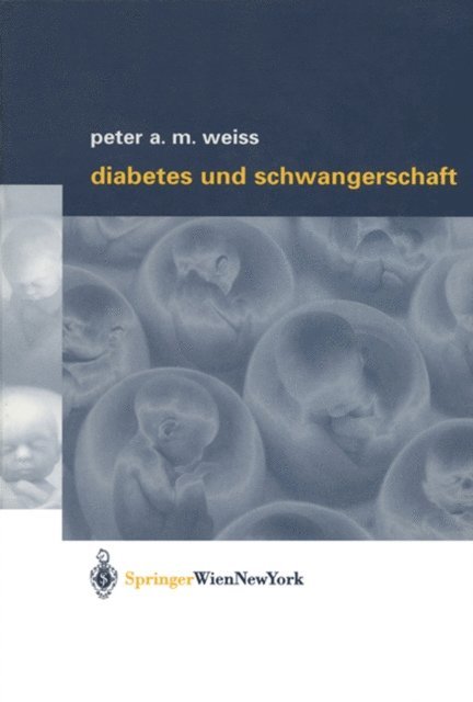 Peter A.M. Weiss - Diabetes und Schwangerschaft, E-bok