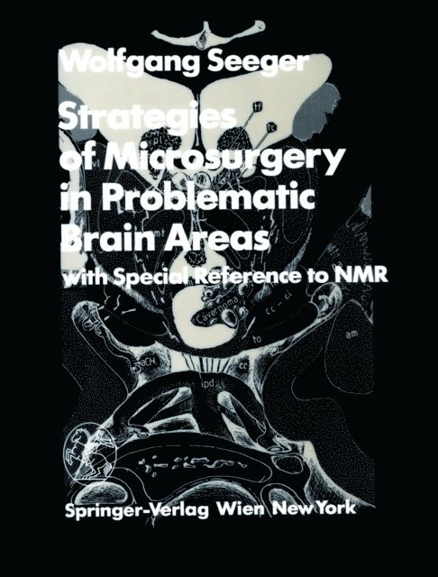 Wolfgang Seeger - Strategies of Microsurgery in Problematic Brain Areas, E-bok