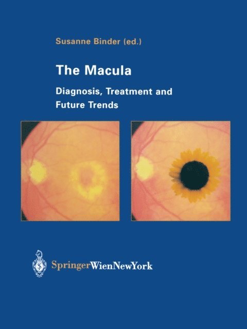 Susanne Binder - Macula, E-bok