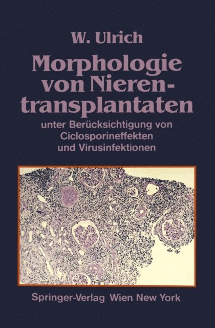 Walter Ulrich - Morphologie von Nierentransplantaten, E-bok