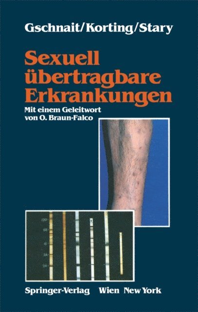 Angelika Stary, Hans C. Korting, Fritz Gschnait - Sexuell übertragbare Erkrankungen, E-bok