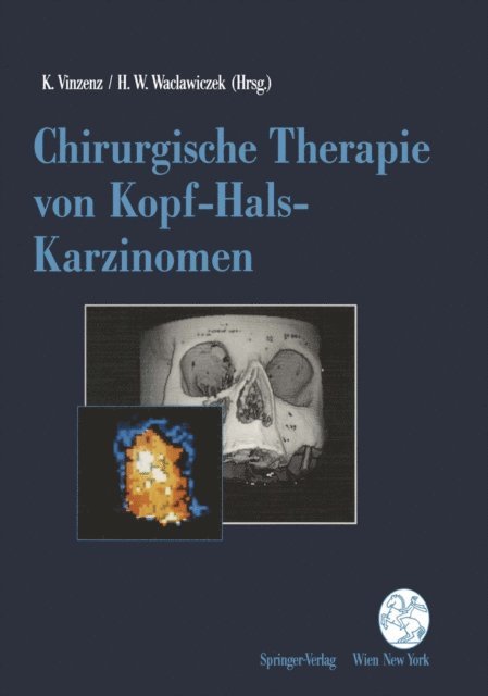 Hans W. Waclawiczek, Kurt Vinzenz - Chirurgische Therapie von Kopf-Hals-Karzinomen, E-bok