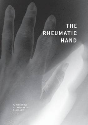Raphael Micheroli, Giorgio Tamborrini, Diego Kyburz - Rheumatic Hand, Häftad