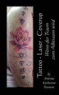 Tattoo - Laser - Cover Up