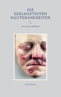 Logan Banner - ekelhaftesten Hautkrankheiten, Häftad. Tillgänglighet: Lägg i varukorg