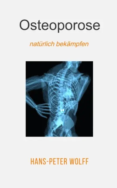 Hans-Peter Wolff - Osteoporose natürlich bekämpfen, E-bok. Tillgänglighet: Lägg i varukorg