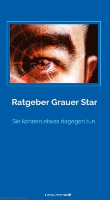 Hans-Peter Wolff - Ratgeber grauer Star, E-bok. Tillgänglighet: Lägg i varukorg