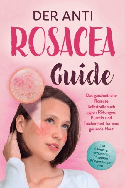 Helena Sandkamp - Der Anti Rosacea Guide: Das ganzheitliche Rosacea Selbsthilfebuch gegen Rotungen, Pusteln und Trockenheit fur eine gesunde Haut - inkl. 4 Wochen Actionplan, Rezepten, Pflegeroutine uvm., E-bok