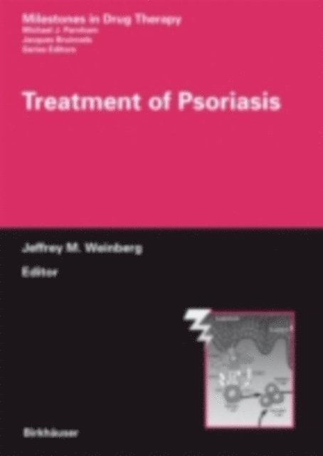 Jeffrey M. Weinberg - Treatment of Psoriasis, E-bok