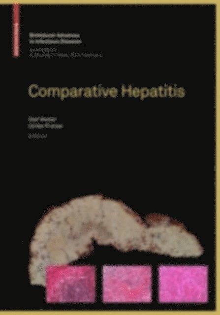 Ulrike Protzer, Olaf Weber - Comparative Hepatitis, E-bok