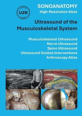 Giorgio Tamborrini - Sonoanatomy - High-Resolution Atlas - Ultrasound of the Musculoskeletal System, Häftad