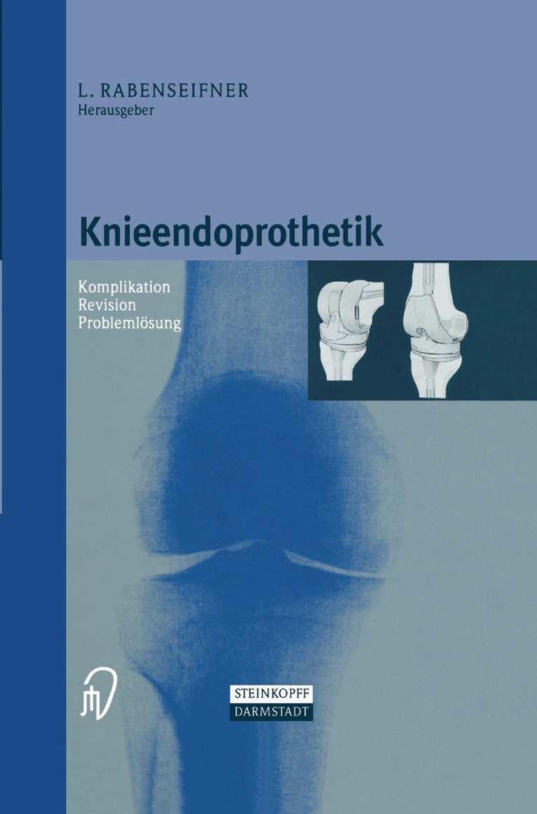 Knieendoprothetik
