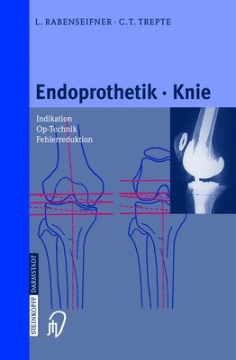 L Rabenseifner, C Trepte - Endoprothetik Knie, Inbunden. Tillgänglighet: Lägg i varukorg