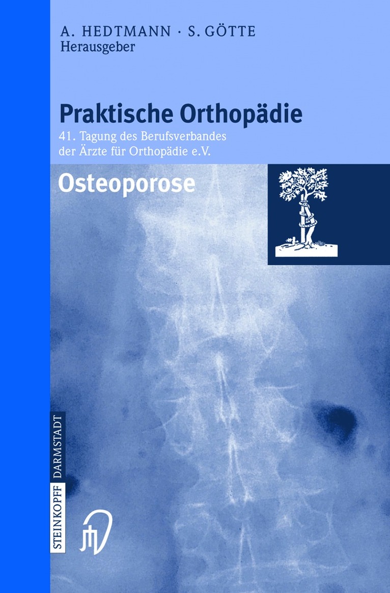 Achim Hedtmann, Siegfried Götte - Osteoporose, Häftad. Tillgänglighet: Lägg i varukorg
