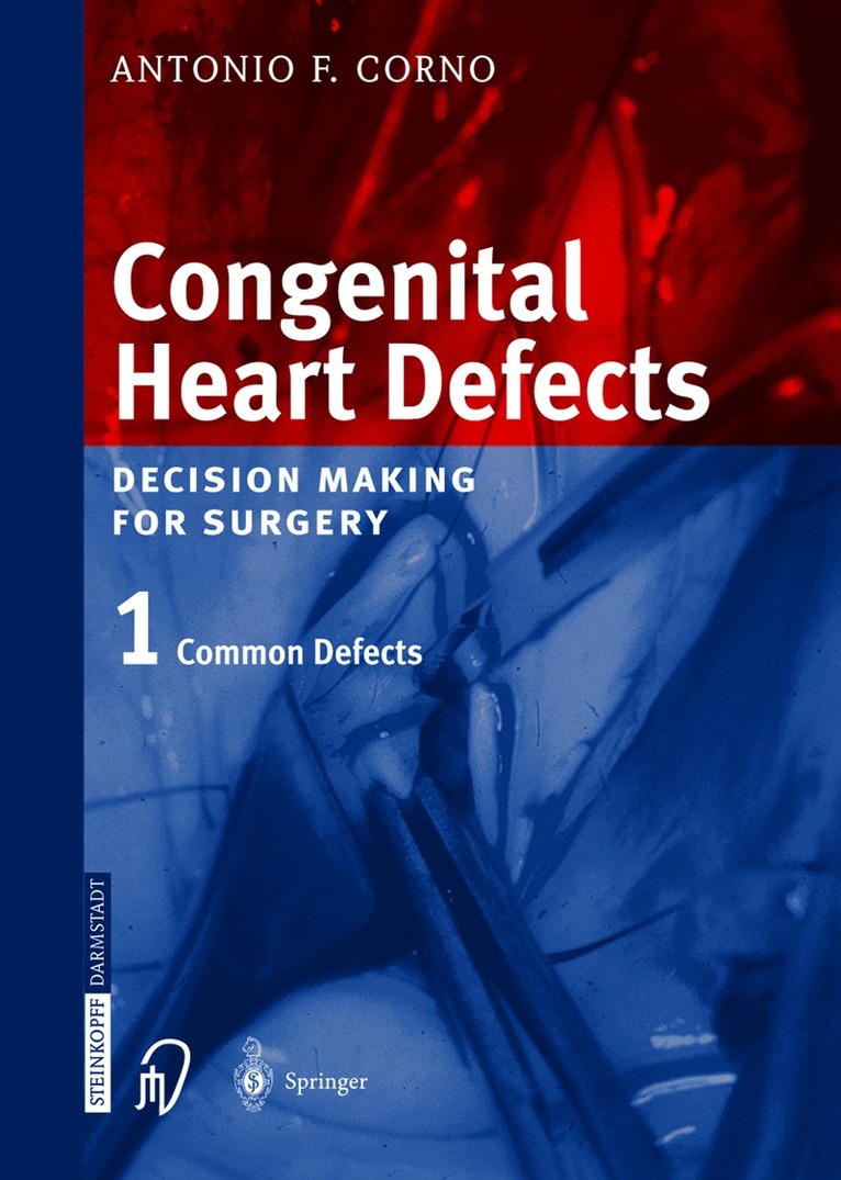 Antonio F. Corno - Congenital Heart Defects, Inbunden. Tillgänglighet: Lägg i varukorg