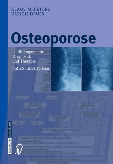Ulrich Deu, Klaus M. Peters - Osteoporose, E-bok