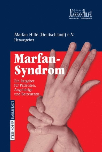 Marfan Hilfe (Deutschland) e. V. - Marfan-Syndrom, E-bok