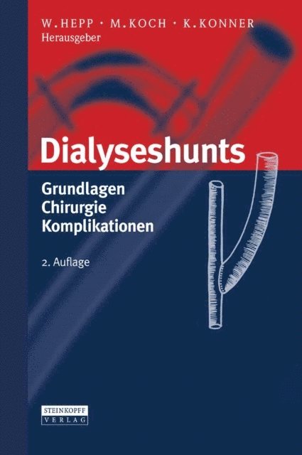 Klaus Konner, Michael Koch, Wolfgang Hepp - Dialyseshunts, E-bok