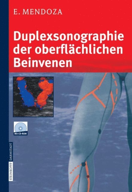 Erika Mendoza - Duplexsonographie der oberflächlichen Beinvenen, E-bok