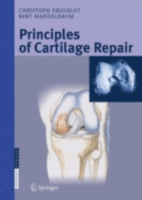 Bert R. Mandelbaum, Christoph Erggelet - Principles of Cartilage Repair, E-bok