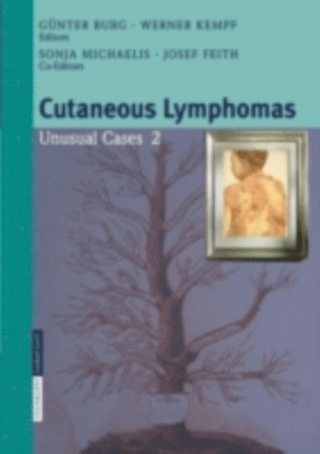 W. Kempf, G. Burg - Cutaneous Lymphomas, E-bok